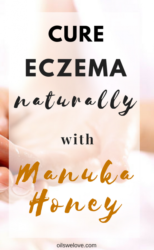 manuka-honey-for-eczema