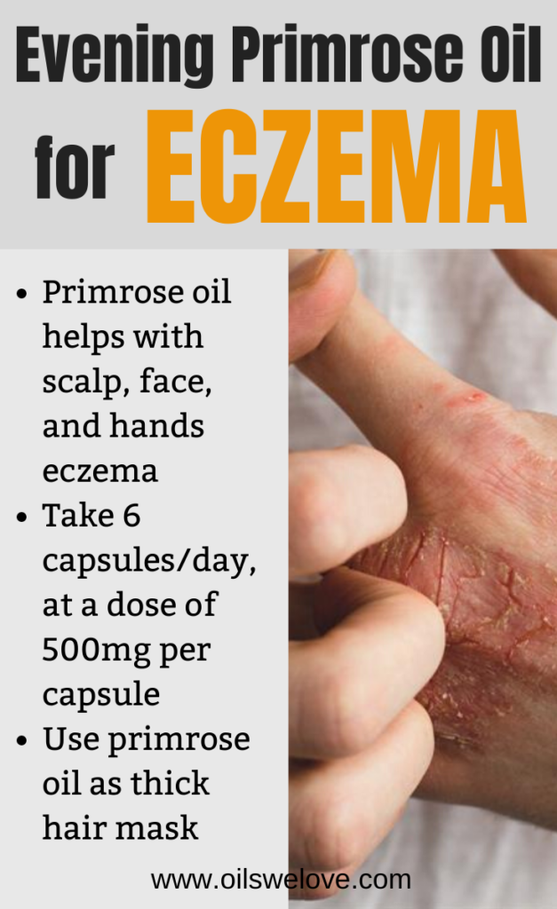 evening-primrose-oil-eczema