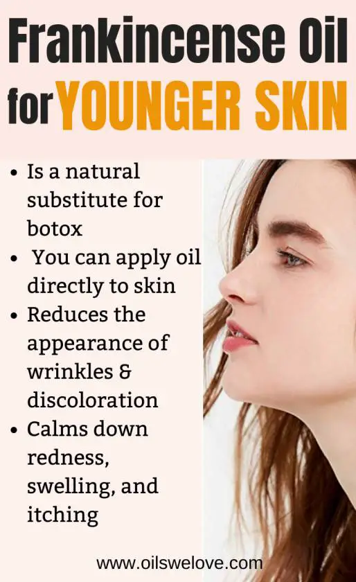  USES OF FRANKINCENSE OIL for skin