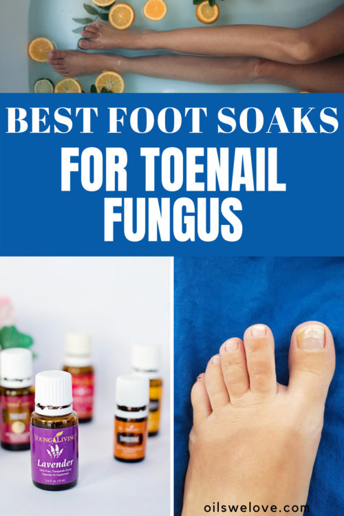 Acollage of images with feet and essential oils showing that DIY foot soak recipes can be effective in treating toenal fungus.